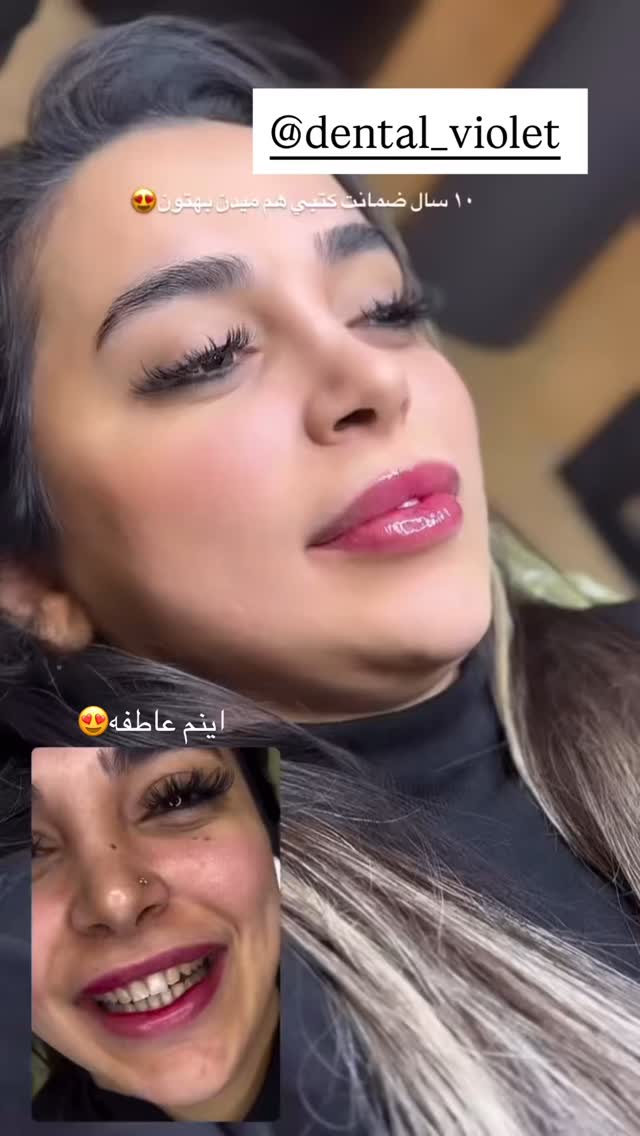  جدید ترین استوری اینستاگرام نگين عابدزاده