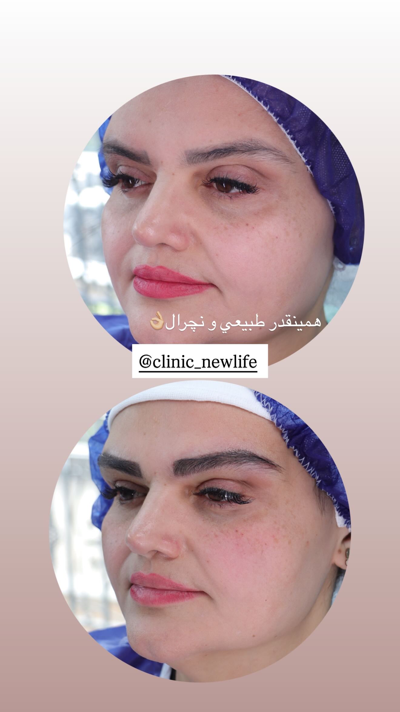  جدید ترین استوری اینستاگرام نگين عابدزاده