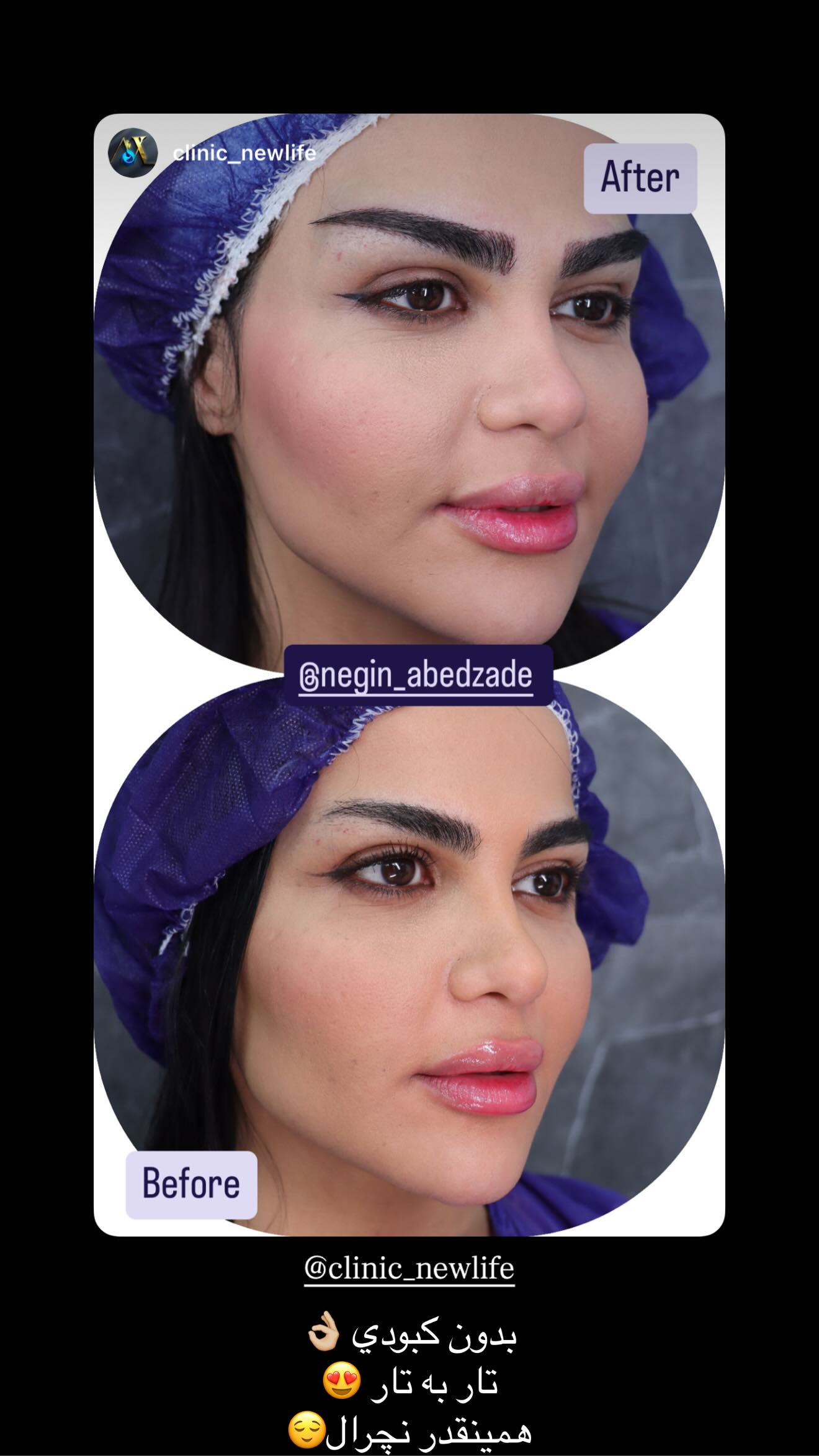  جدید ترین استوری اینستاگرام نگين عابدزاده