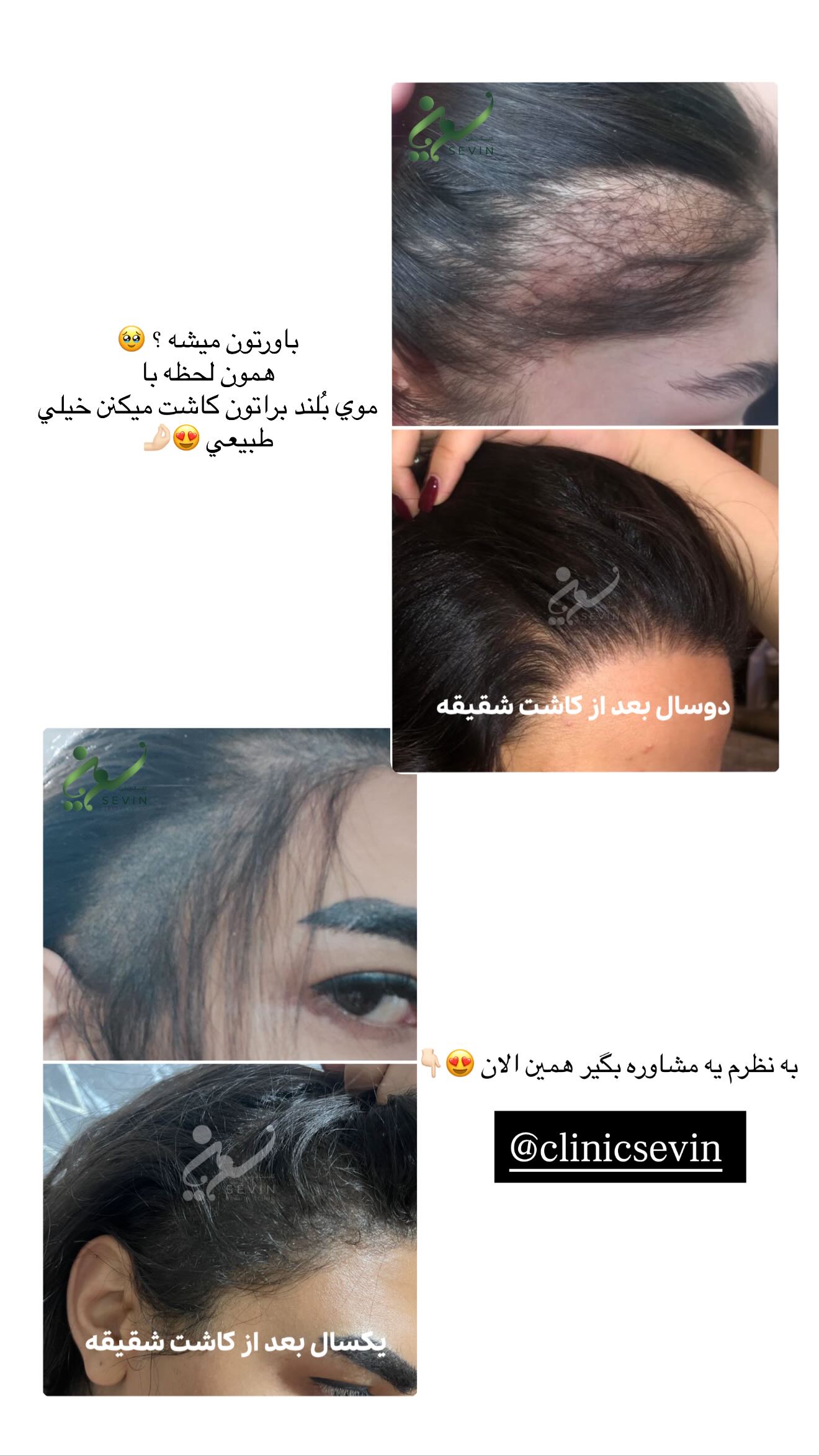  جدید ترین استوری اینستاگرام نگين عابدزاده