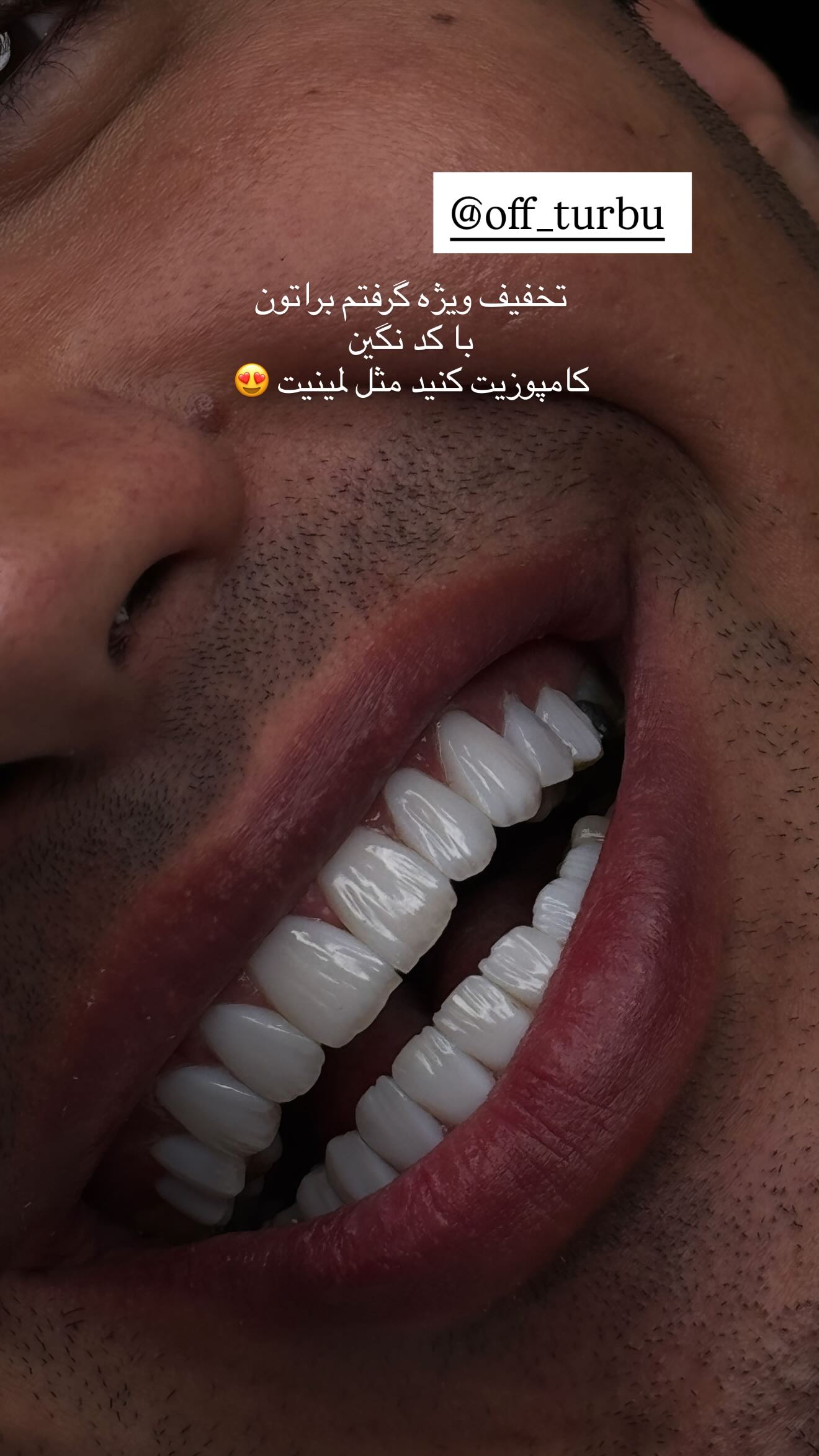  جدید ترین استوری اینستاگرام نگين عابدزاده