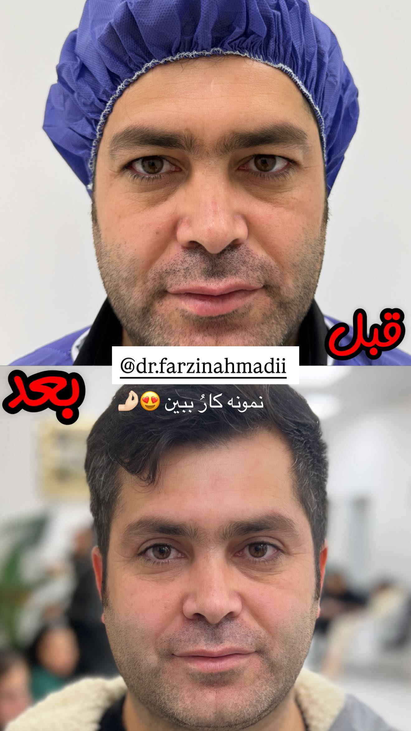 جدید ترین استوری اینستاگرام نگين عابدزاده