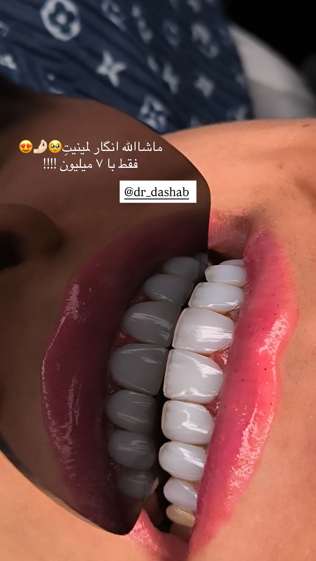  جدید ترین استوری اینستاگرام نگين عابدزاده