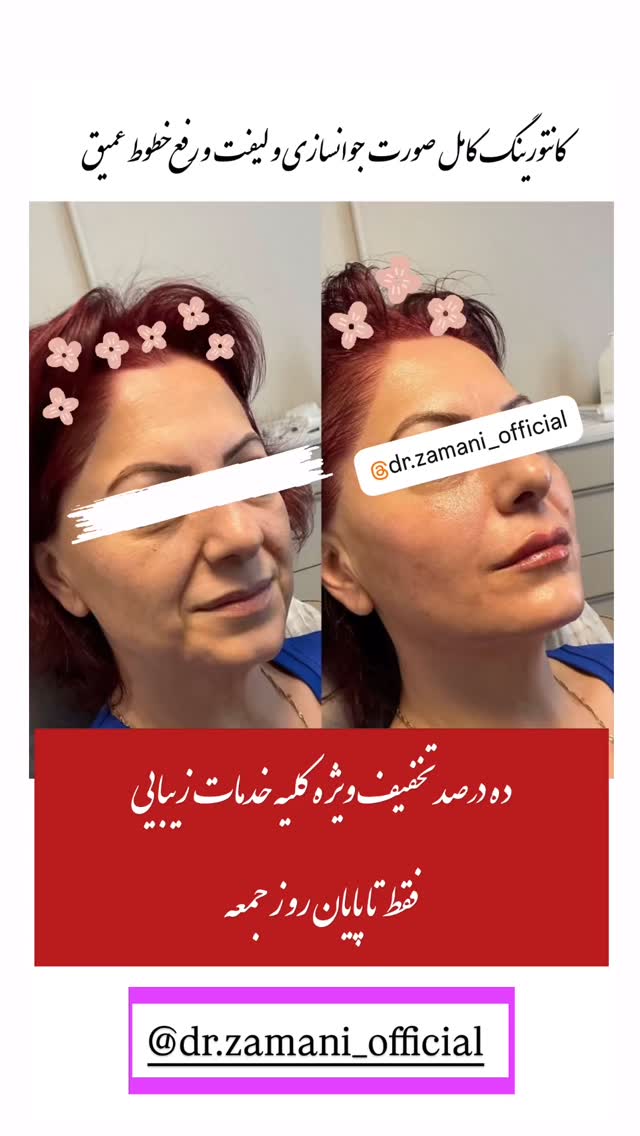  جدید ترین استوری اینستاگرام نگين عابدزاده