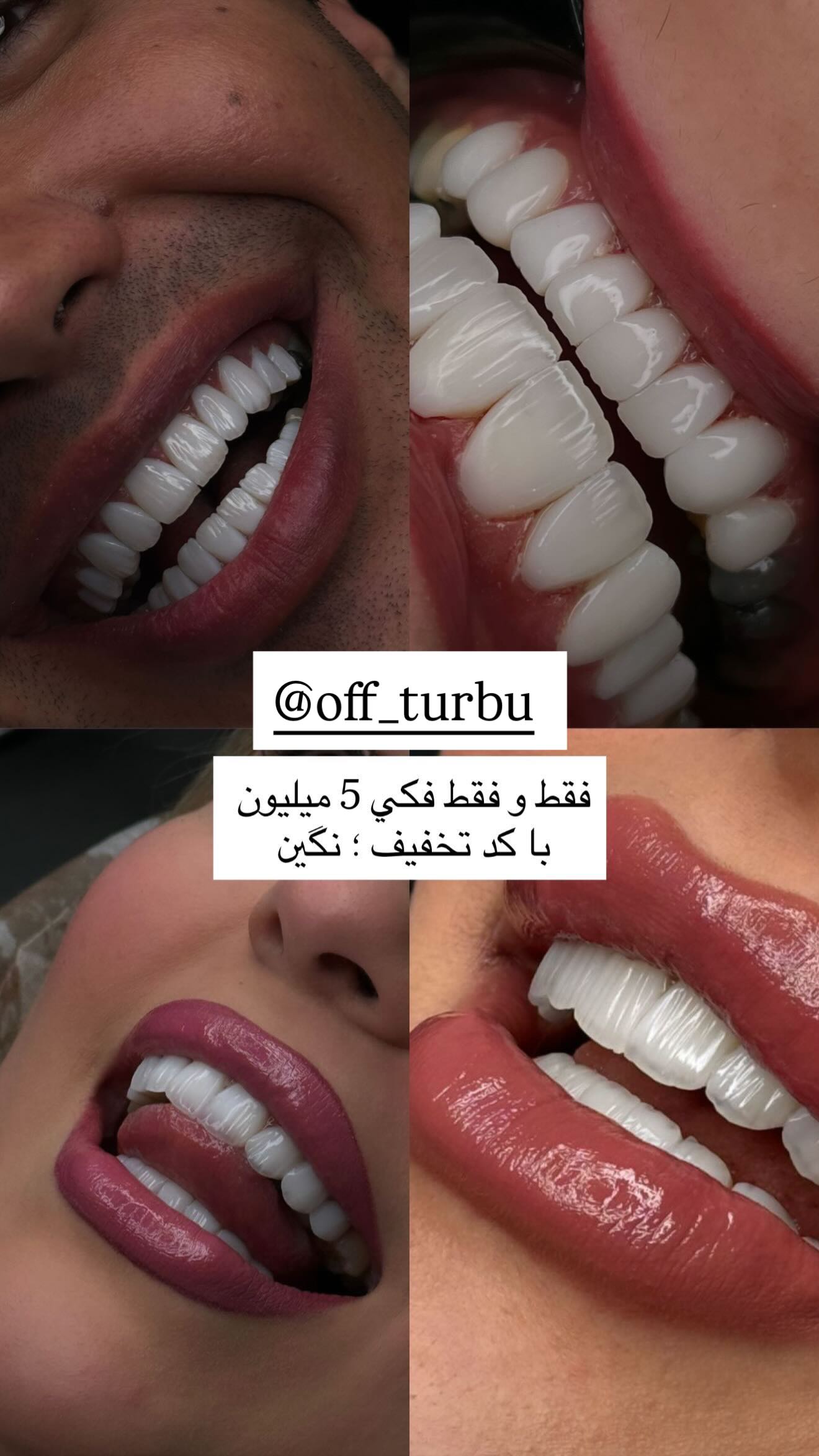  جدید ترین استوری اینستاگرام نگين عابدزاده