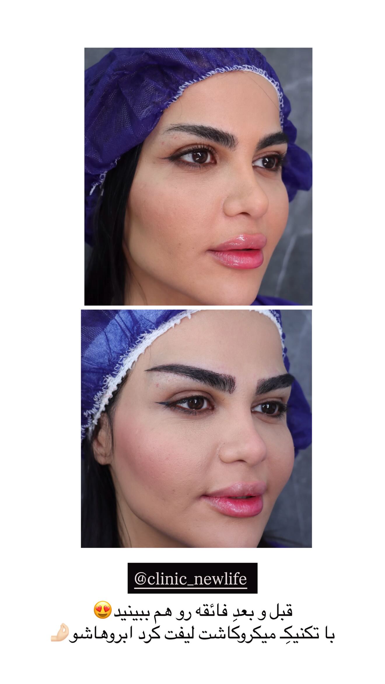  جدید ترین استوری اینستاگرام نگين عابدزاده