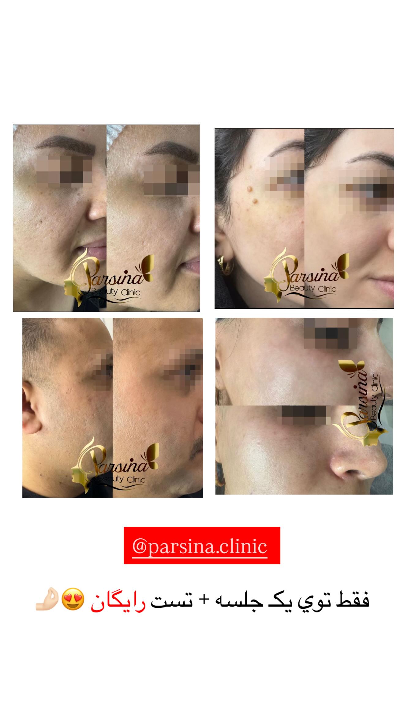  جدید ترین استوری اینستاگرام نگين عابدزاده