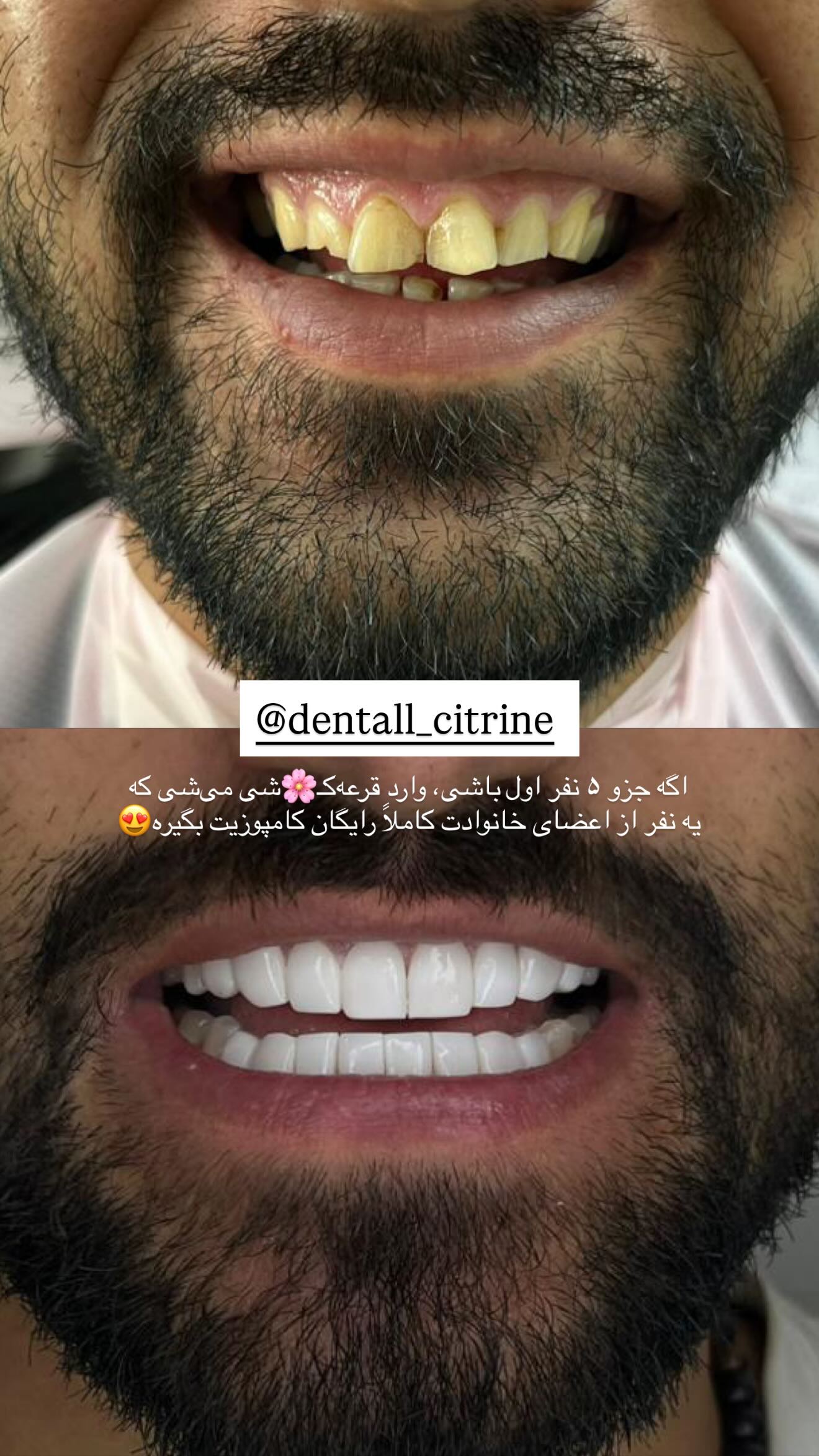  جدید ترین استوری اینستاگرام نگين عابدزاده
