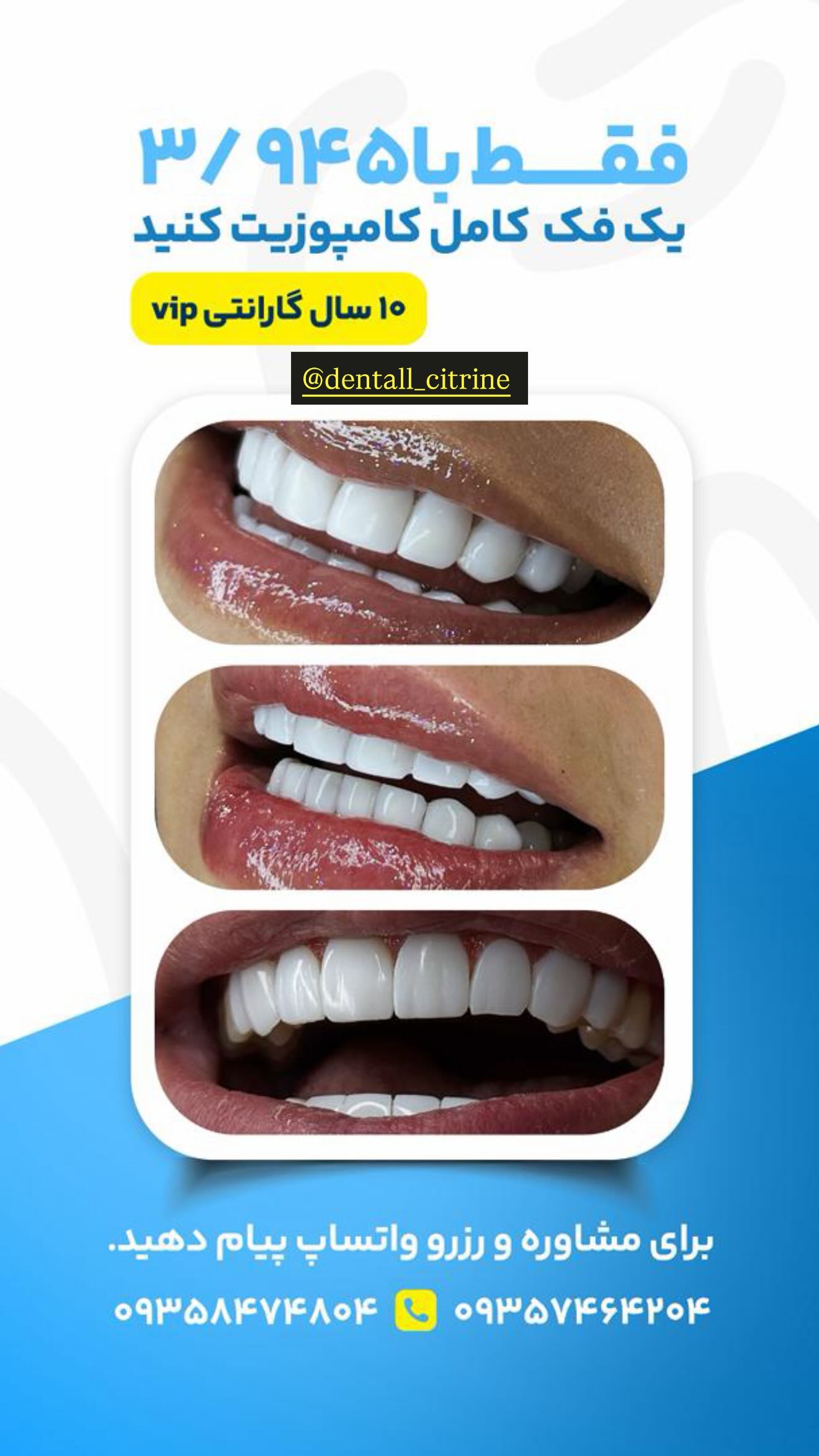  جدید ترین استوری اینستاگرام نگين عابدزاده