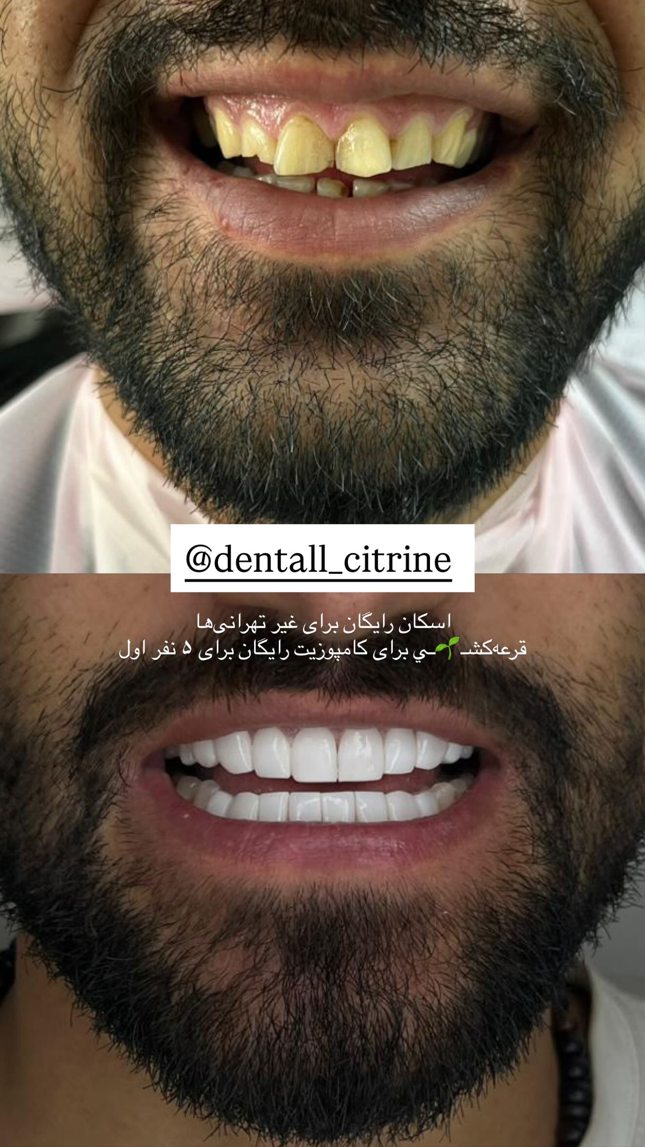  جدید ترین استوری اینستاگرام نگين عابدزاده