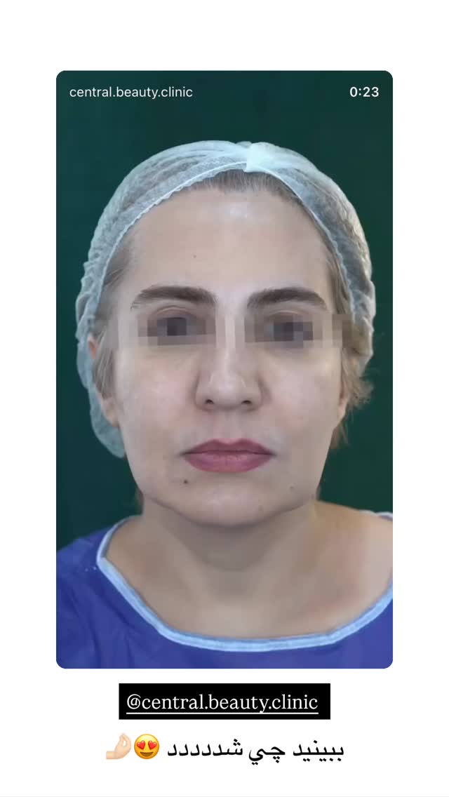  جدید ترین استوری اینستاگرام نگين عابدزاده