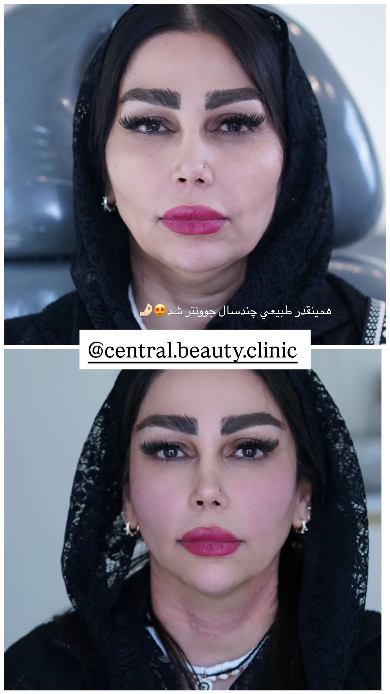 جدید ترین استوری اینستاگرام نگين عابدزاده