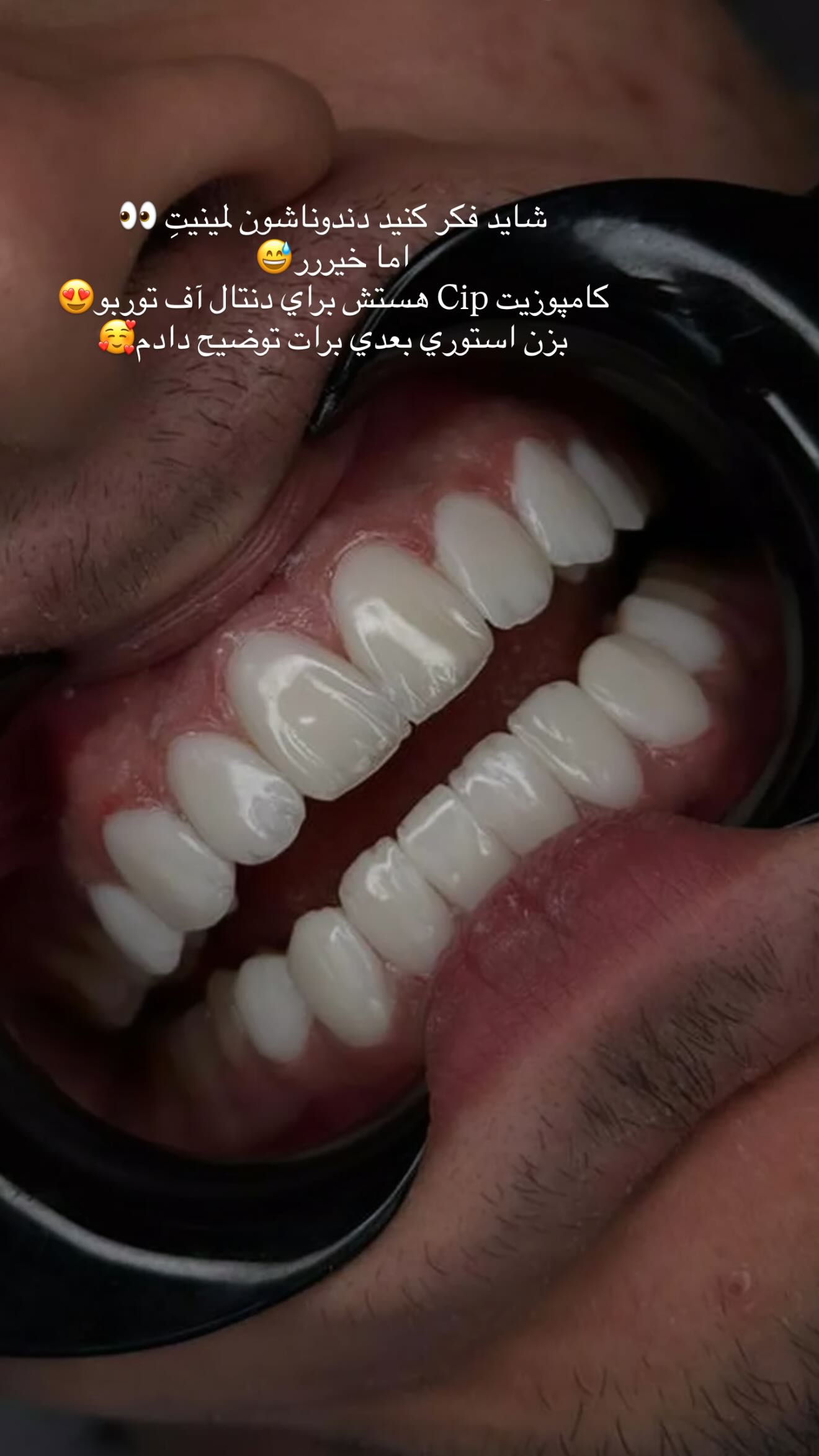  جدید ترین استوری اینستاگرام نگين عابدزاده