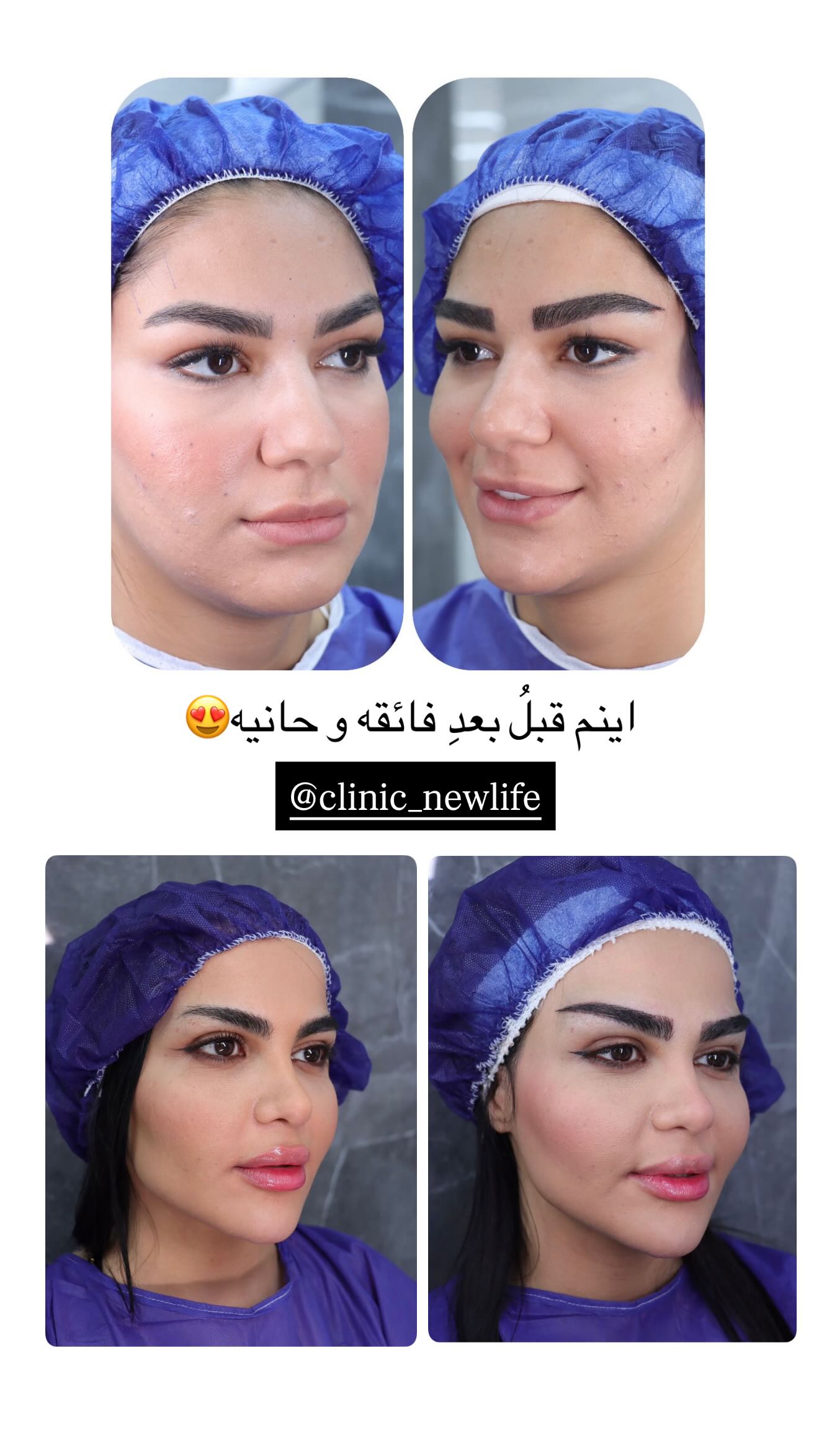  جدید ترین استوری اینستاگرام نگين عابدزاده