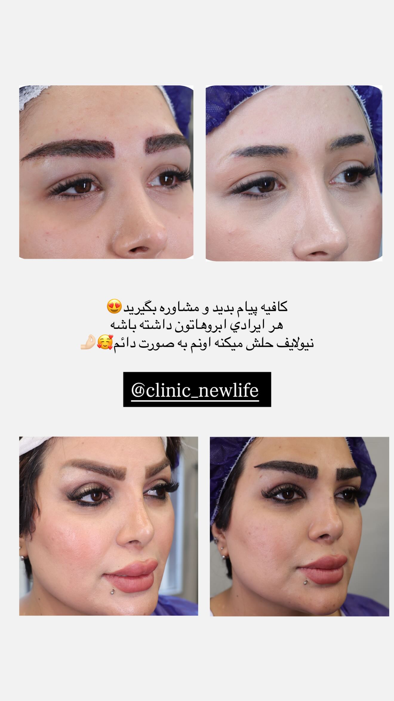  جدید ترین استوری اینستاگرام نگين عابدزاده