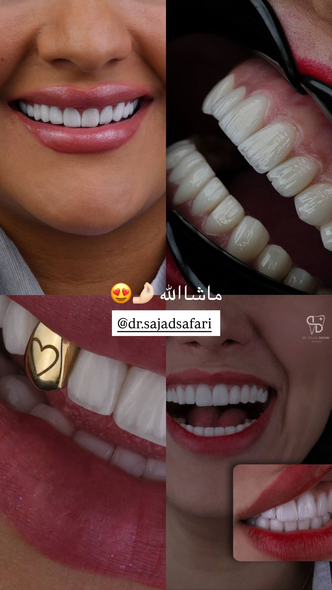  جدید ترین استوری اینستاگرام نگين عابدزاده