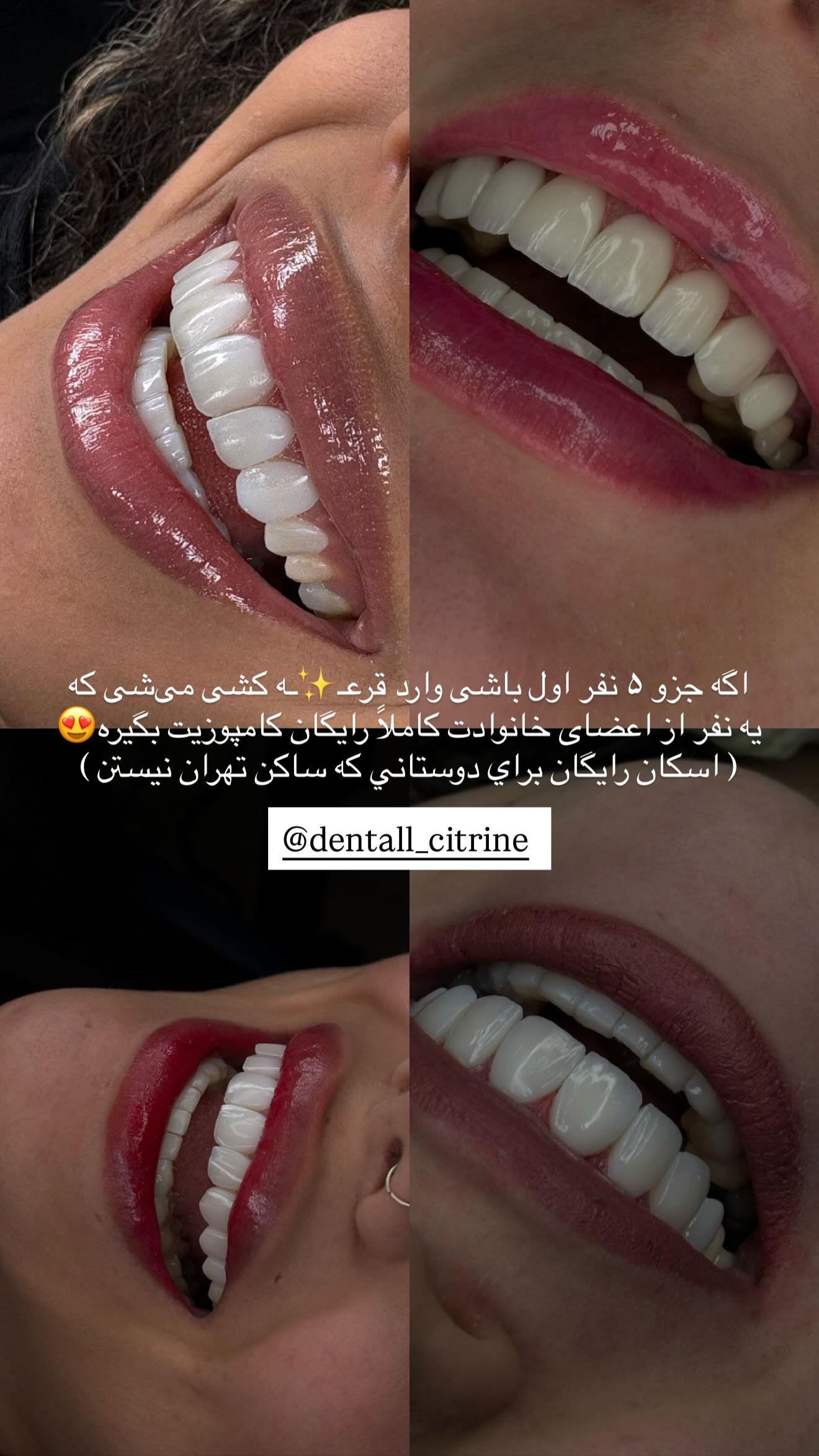  جدید ترین استوری اینستاگرام نگين عابدزاده
