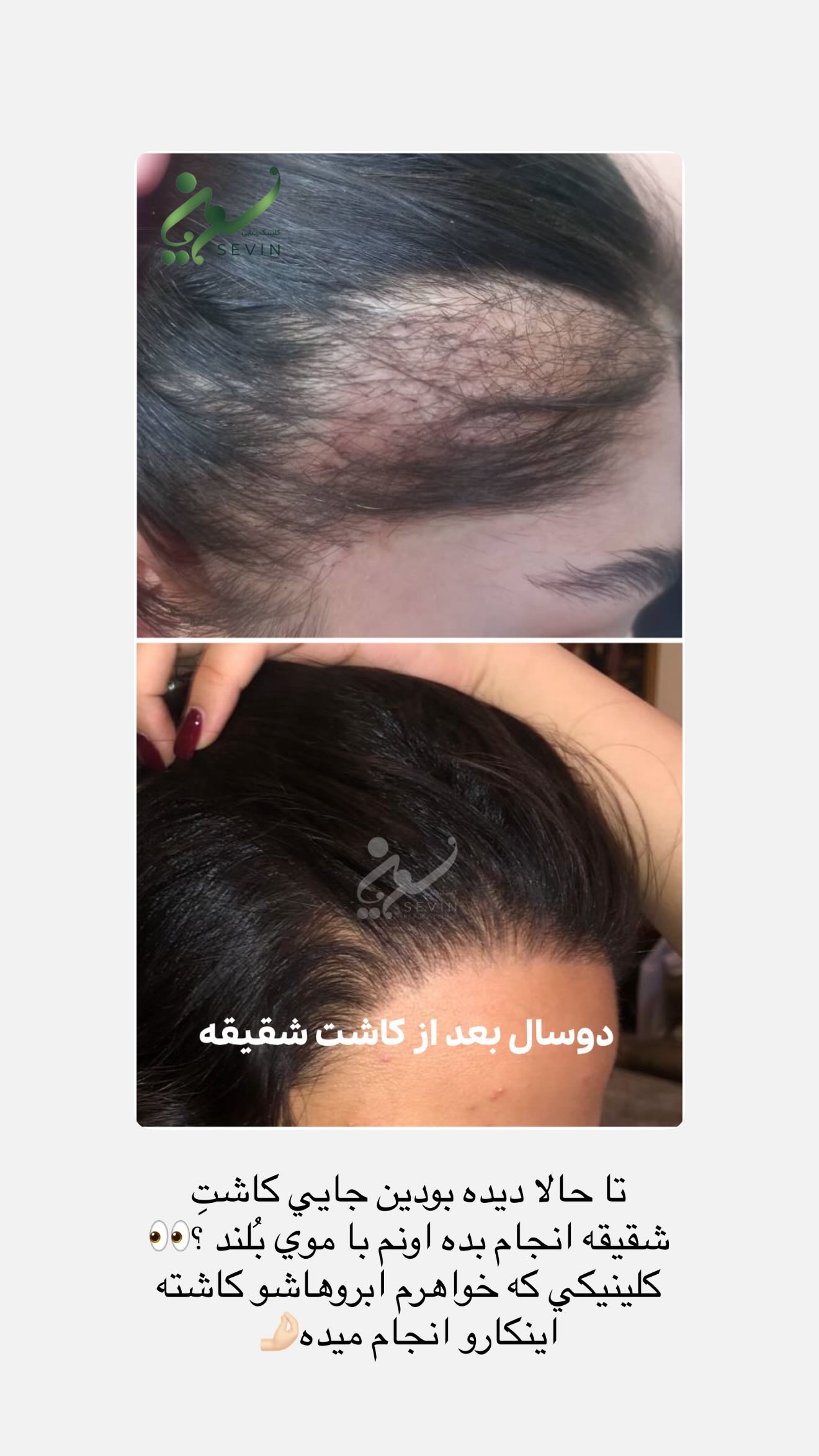  جدید ترین استوری اینستاگرام نگين عابدزاده
