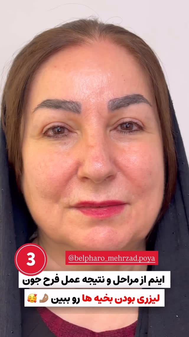 جدید ترین استوری اینستاگرام نگين عابدزاده