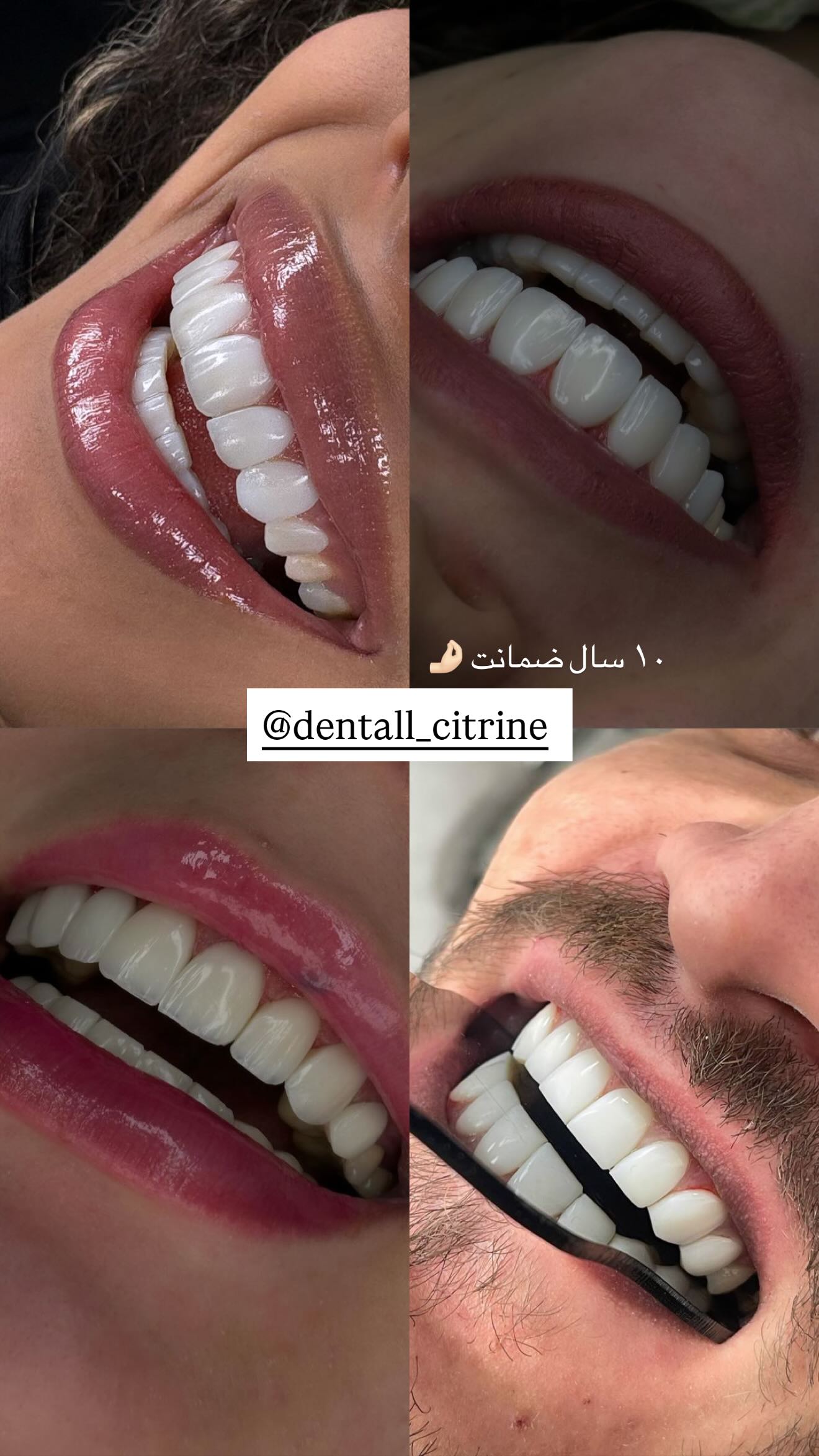  جدید ترین استوری اینستاگرام نگين عابدزاده