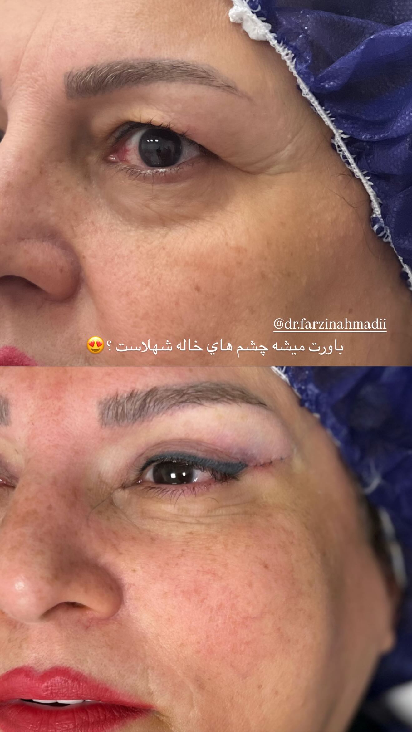  جدید ترین استوری اینستاگرام نگين عابدزاده