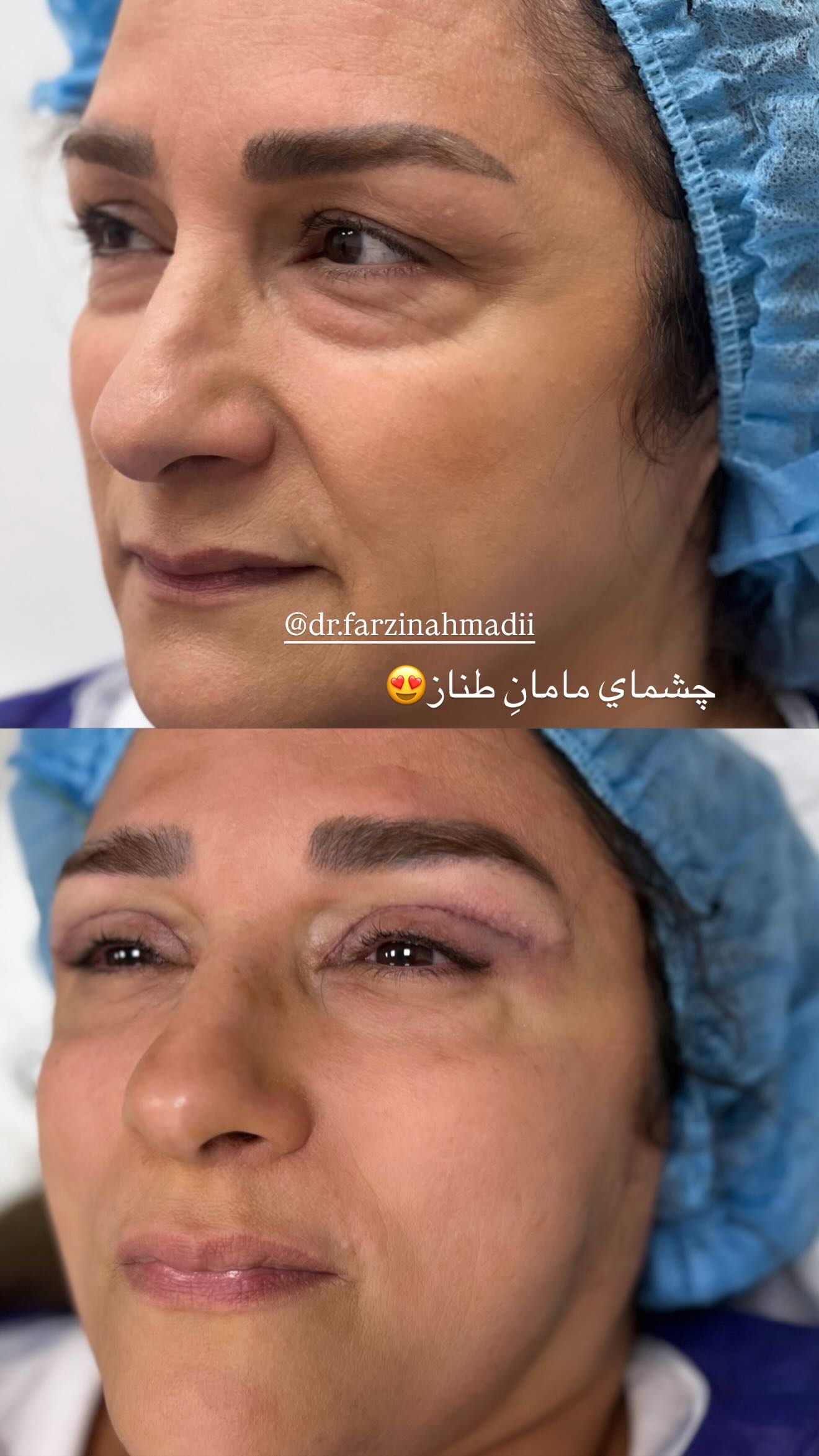  جدید ترین استوری اینستاگرام نگين عابدزاده