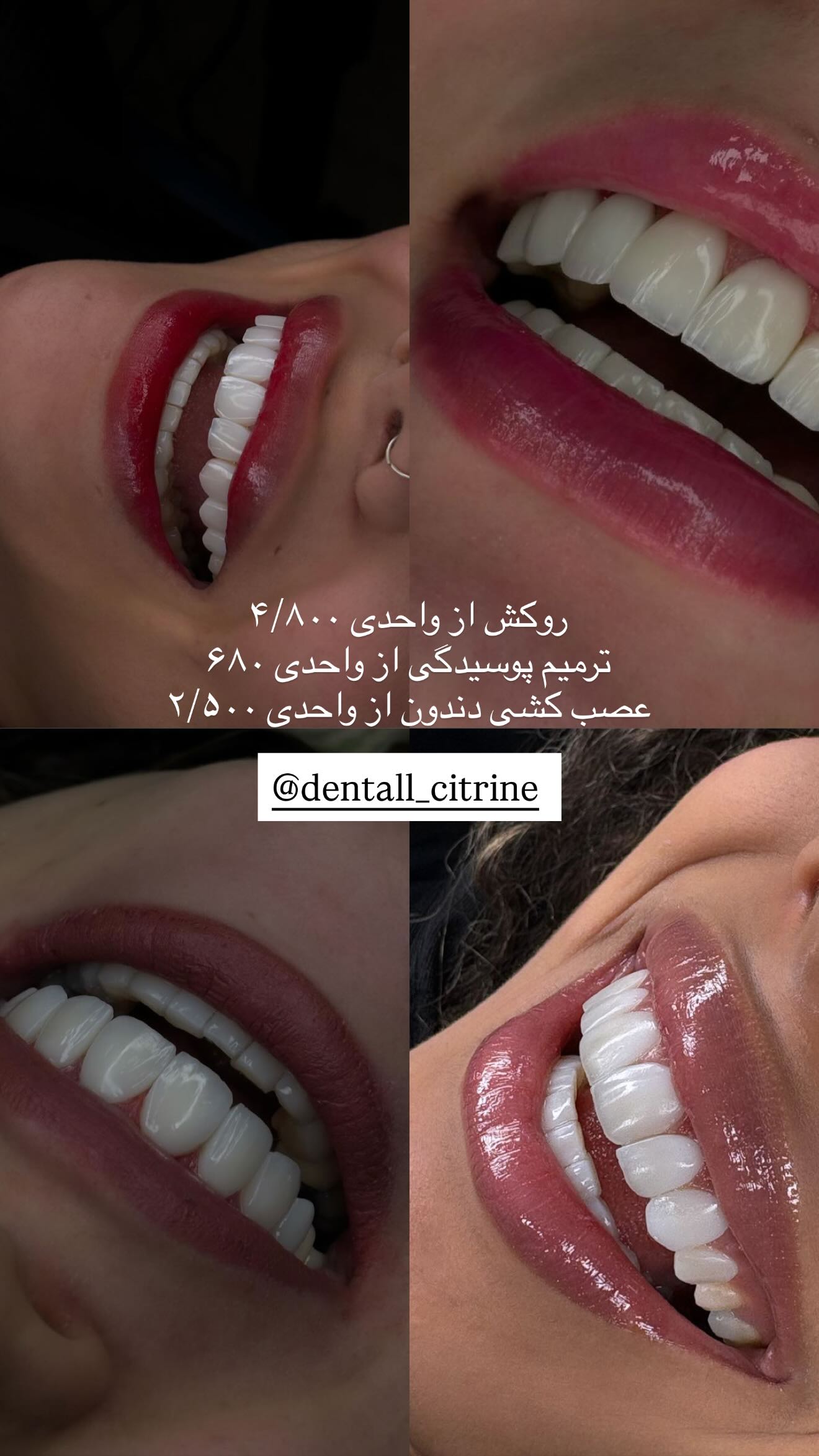  جدید ترین استوری اینستاگرام نگين عابدزاده