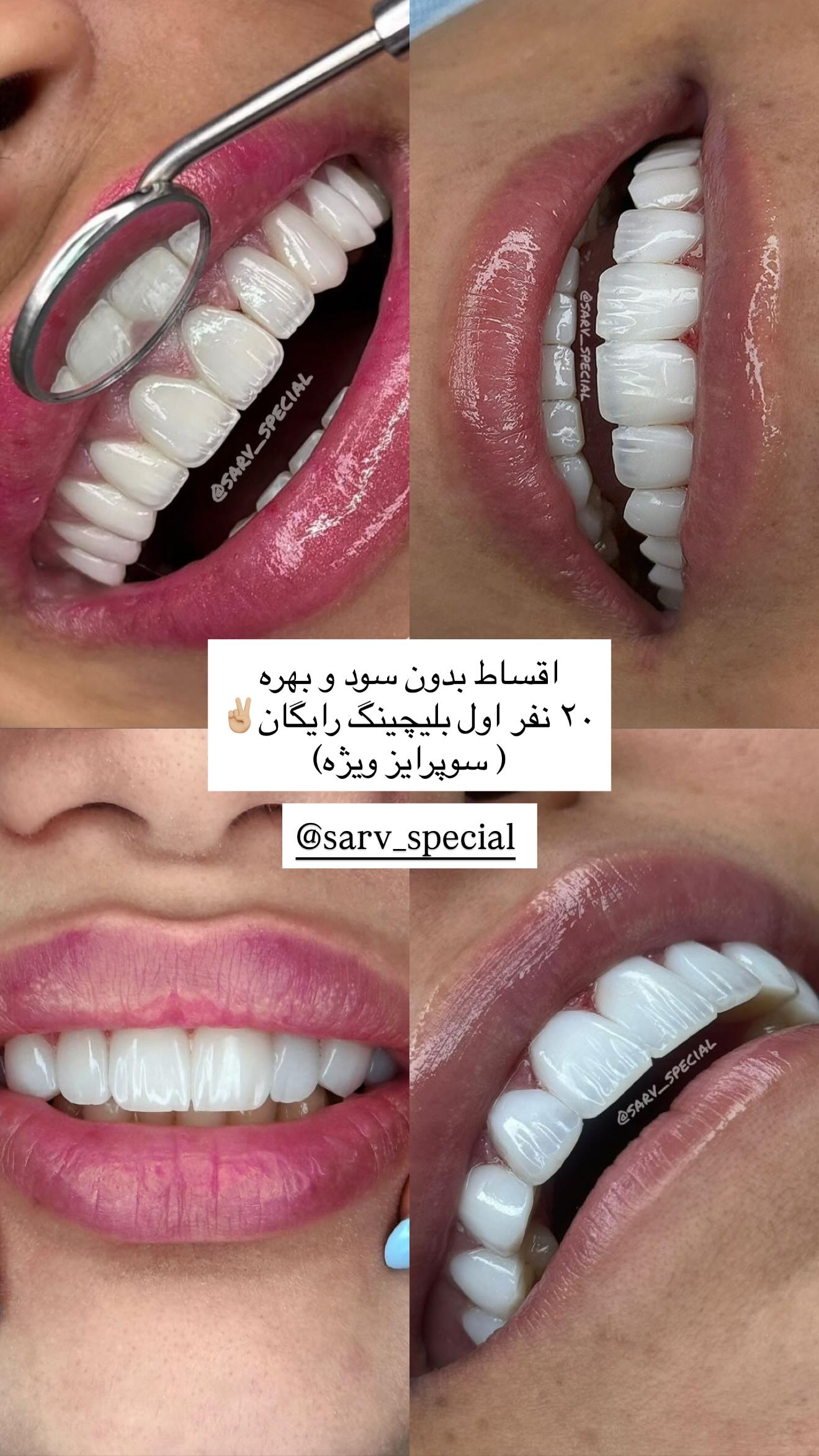  جدید ترین استوری اینستاگرام نگين عابدزاده