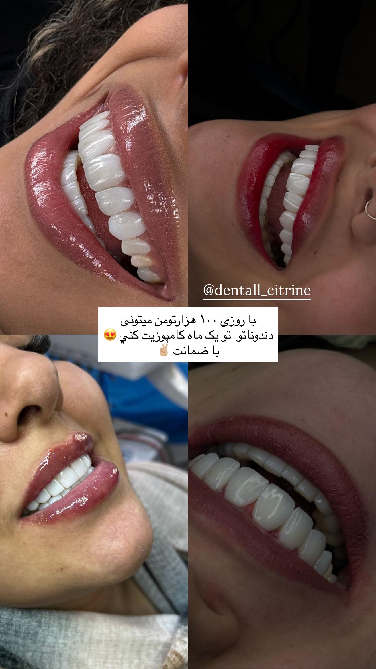 جدید ترین استوری اینستاگرام نگين عابدزاده