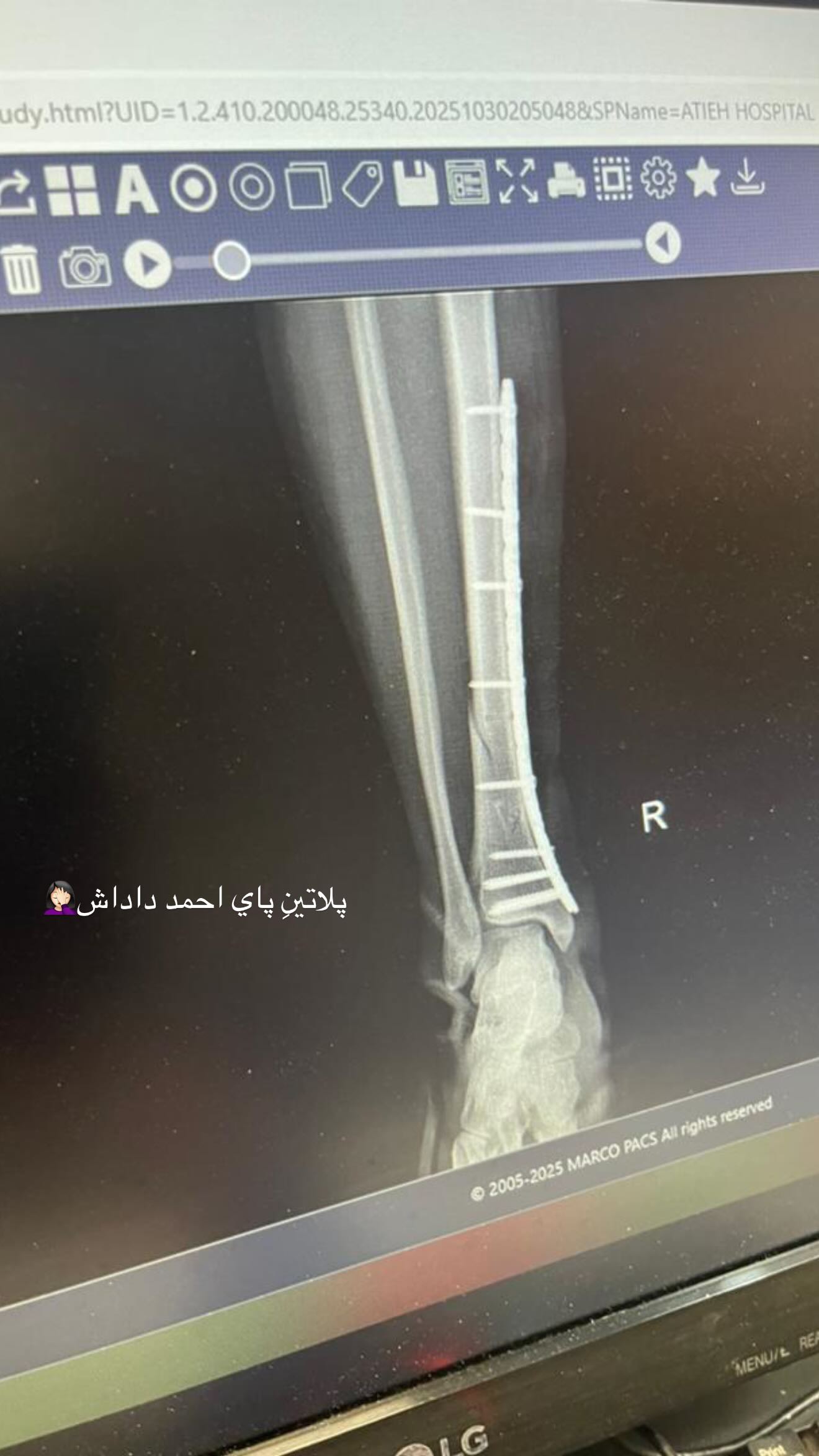  جدید ترین استوری اینستاگرام نگين عابدزاده