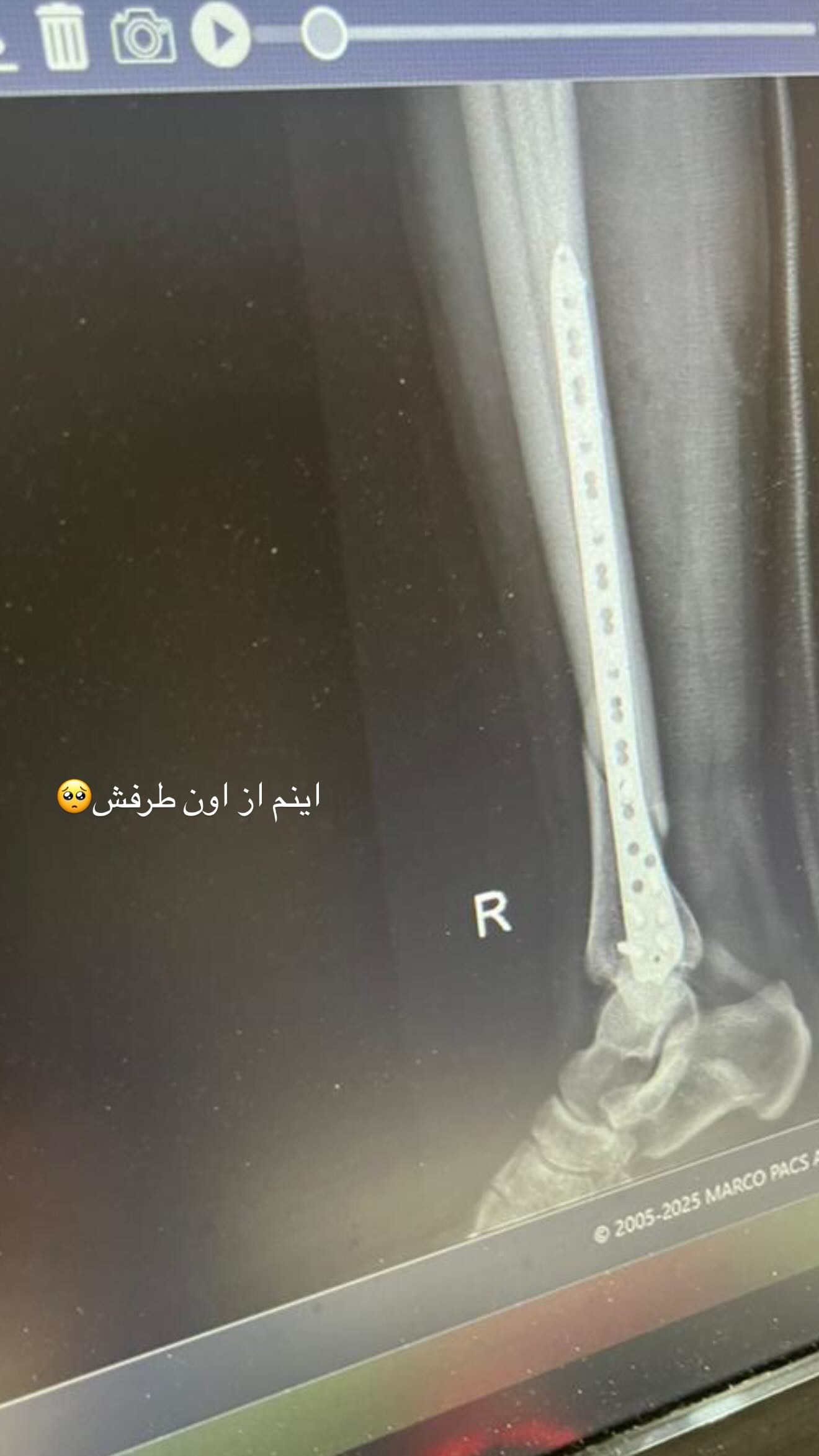  جدید ترین استوری اینستاگرام نگين عابدزاده
