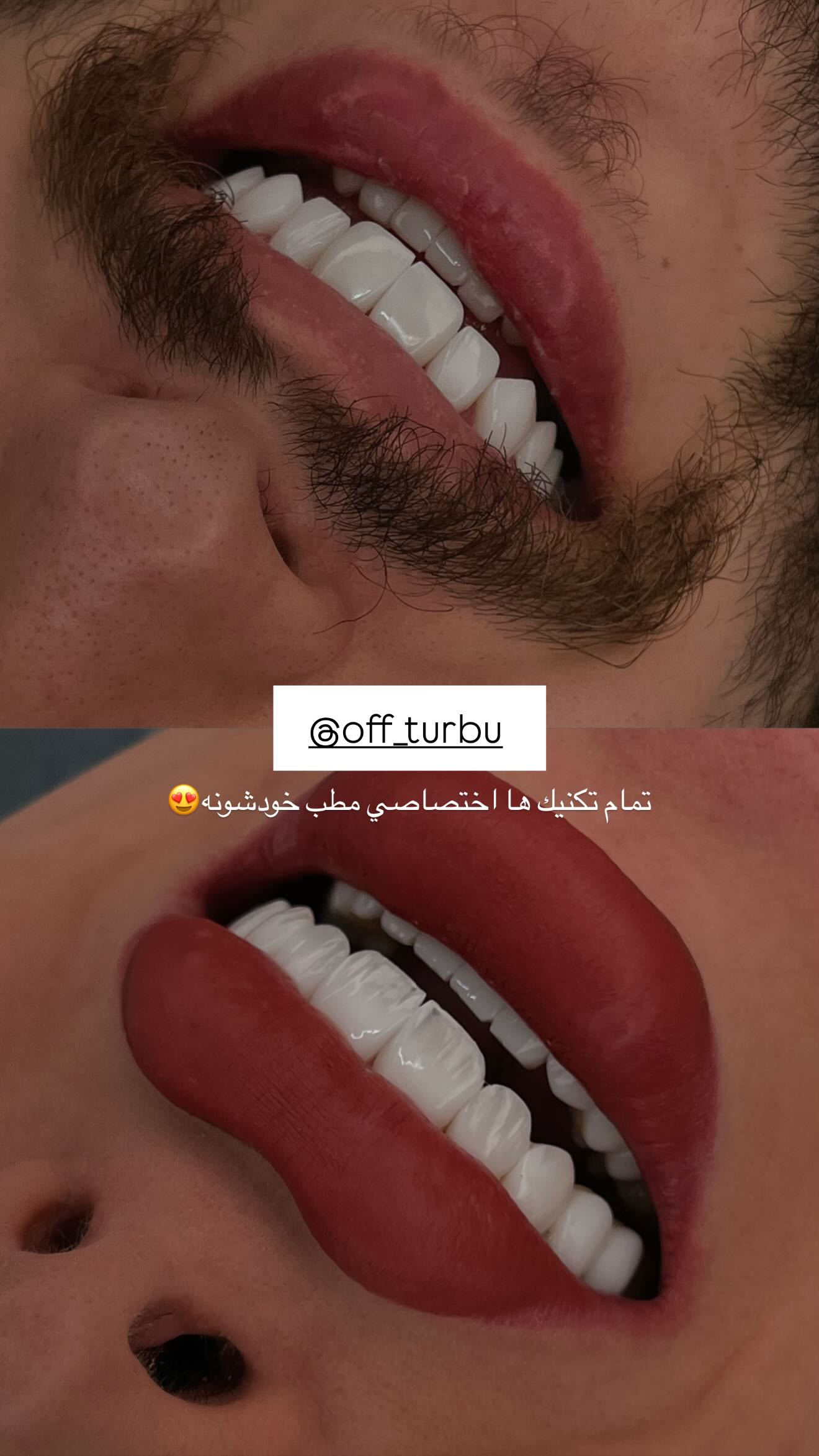  جدید ترین استوری اینستاگرام نگين عابدزاده