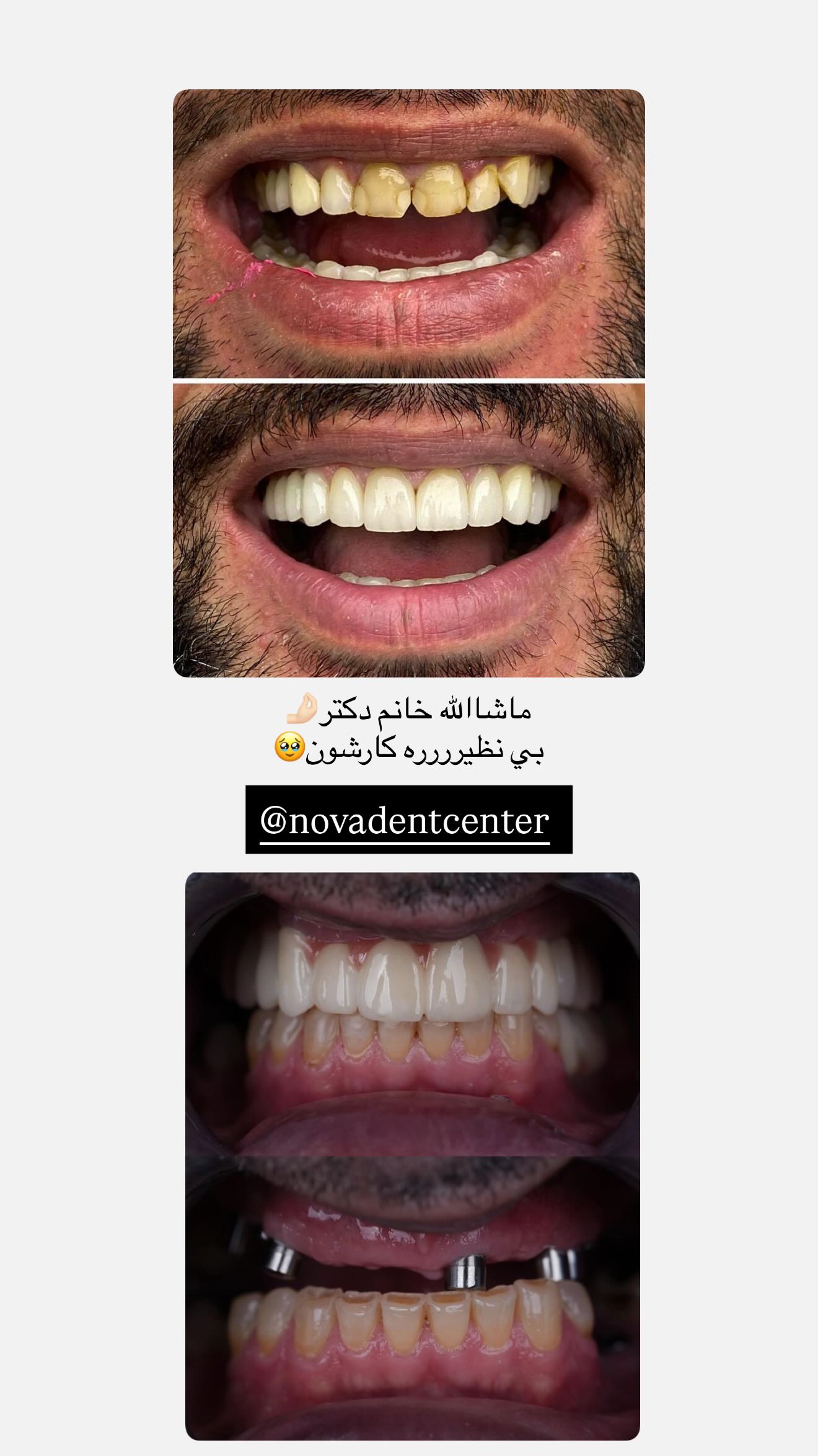  جدید ترین استوری اینستاگرام نگين عابدزاده