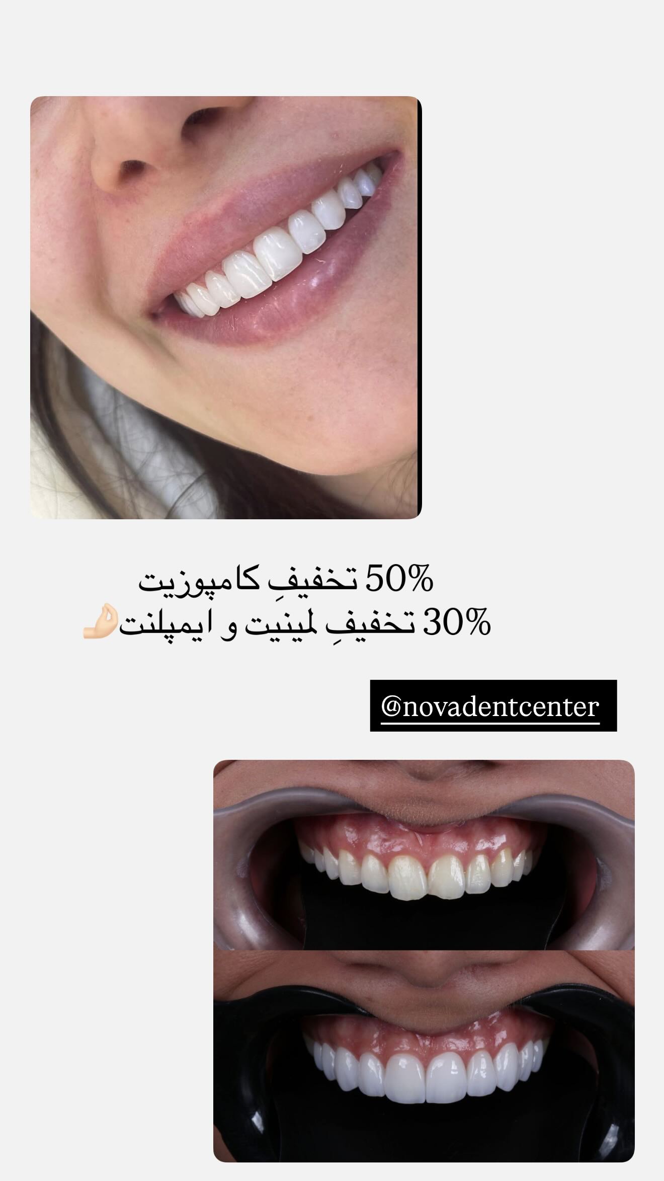  جدید ترین استوری اینستاگرام نگين عابدزاده