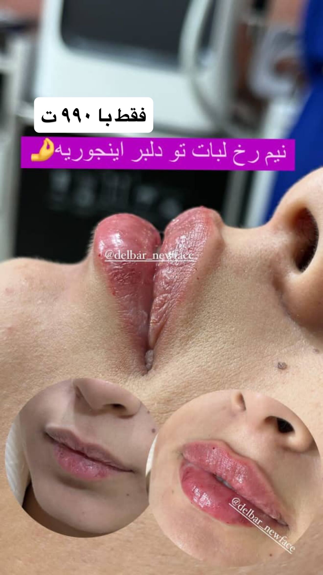  جدید ترین استوری اینستاگرام نگین کدیور