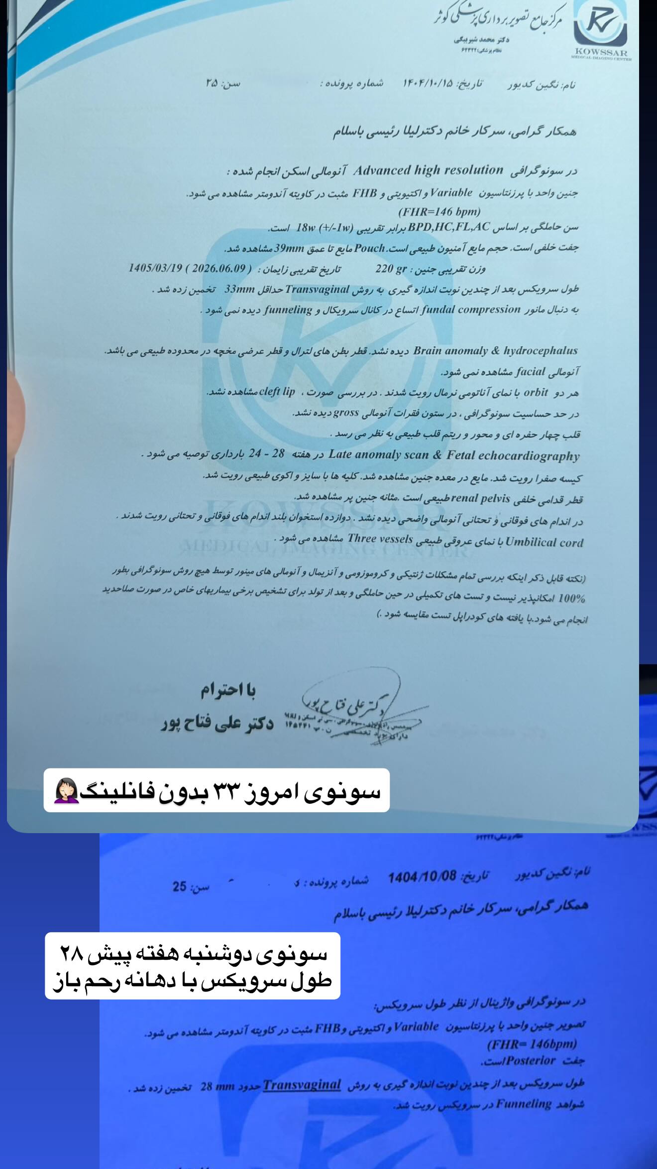  جدید ترین استوری اینستاگرام نگین کدیور