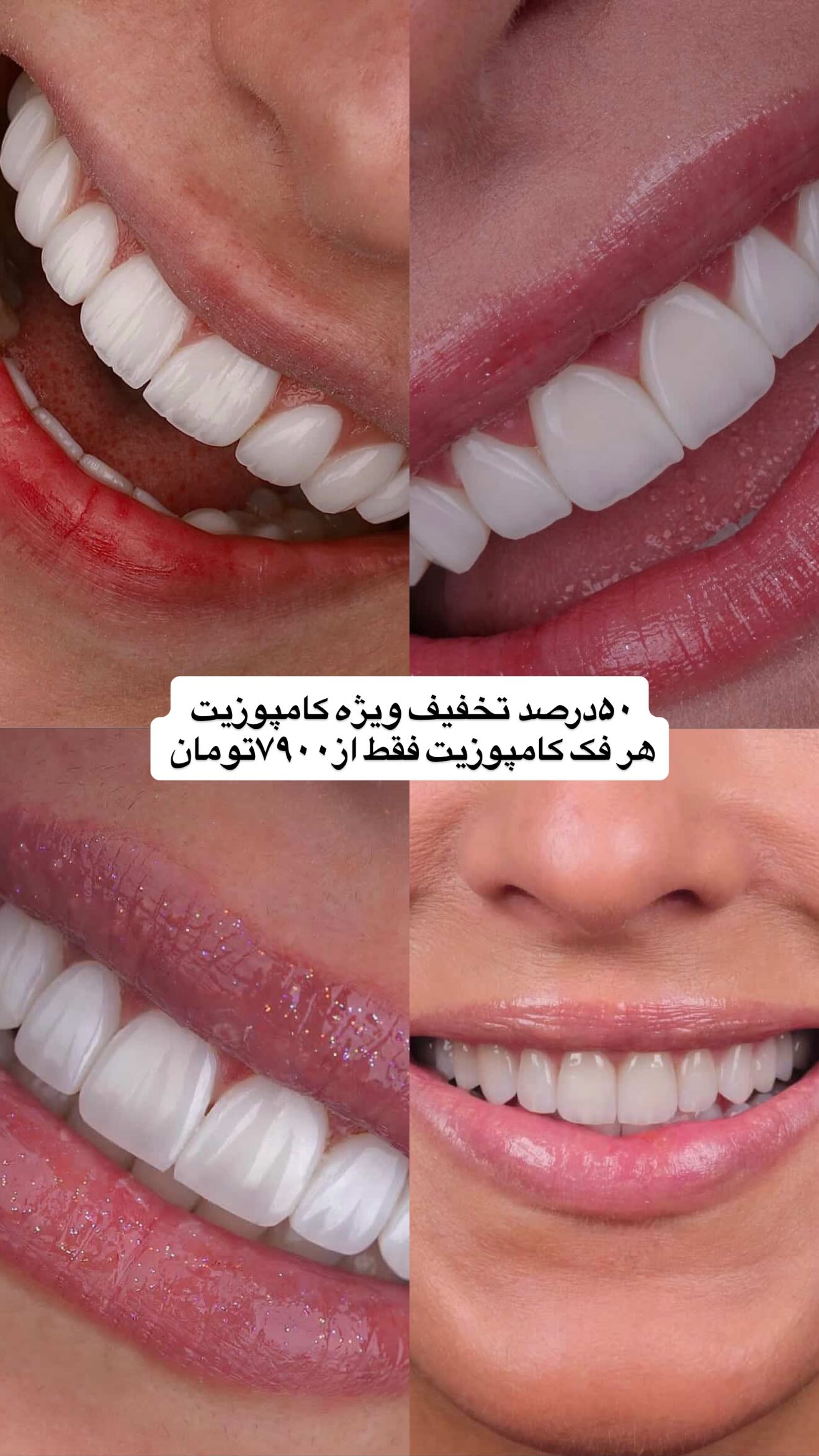  جدید ترین استوری اینستاگرام نگین کدیور