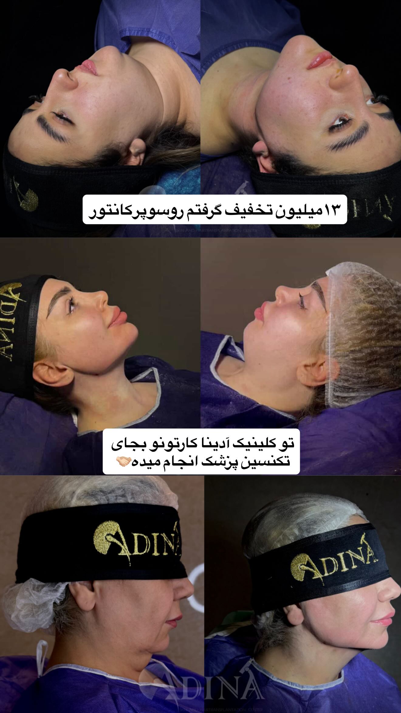 جدید ترین استوری اینستاگرام نگین کدیور