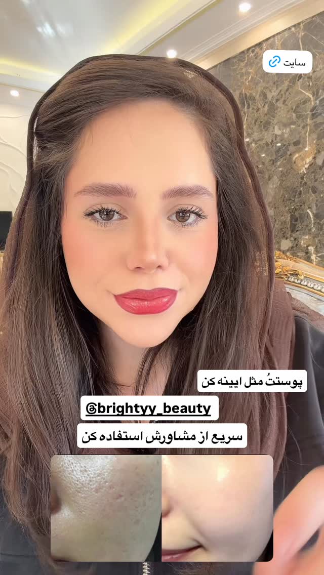  جدید ترین استوری اینستاگرام نگین کدیور