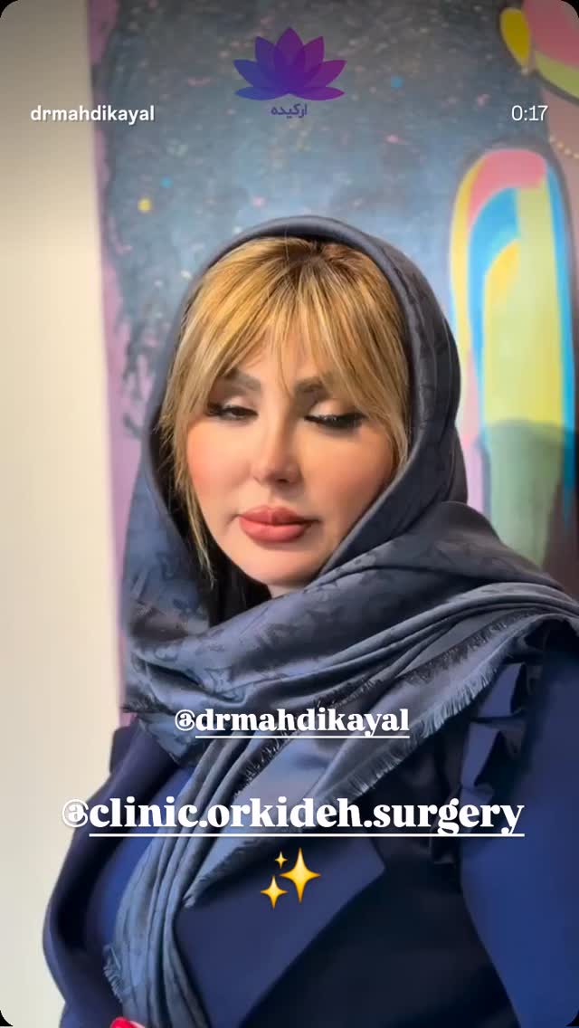  جدید ترین استوری اینستاگرام نیوشا ضیغمی