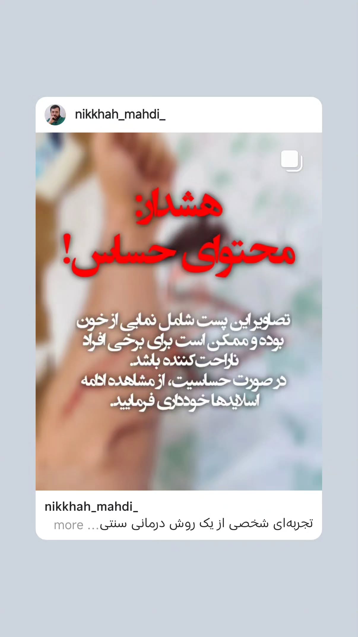  جدید ترین استوری اینستاگرام مهدی نیکخواه