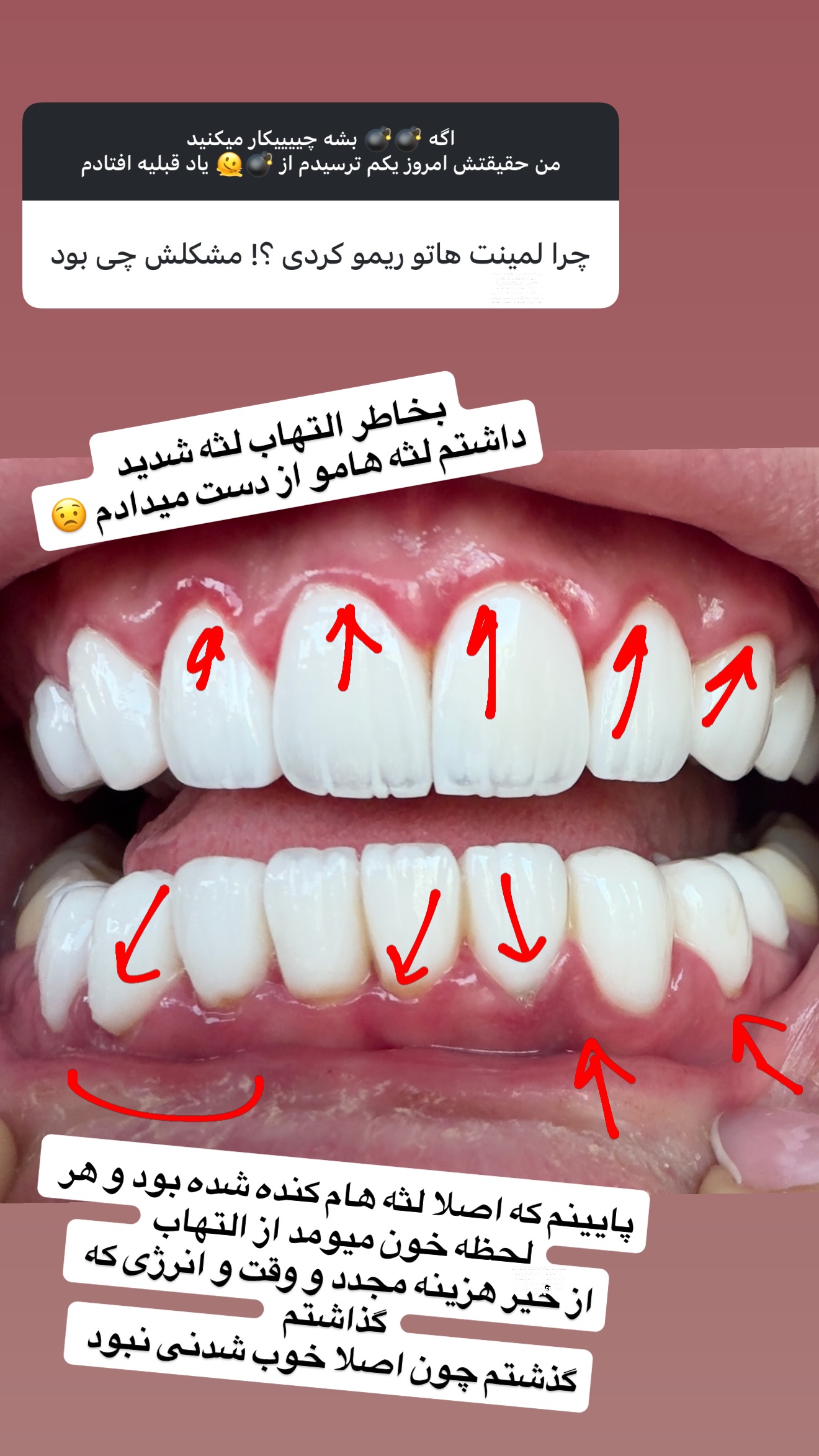  جدید ترین استوری اینستاگرام نیلوفر بهبودی