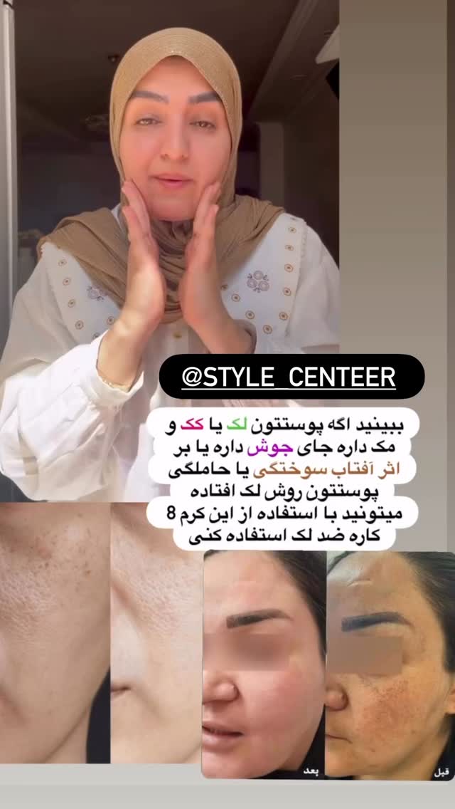  جدید ترین استوری اینستاگرام نورا بانو