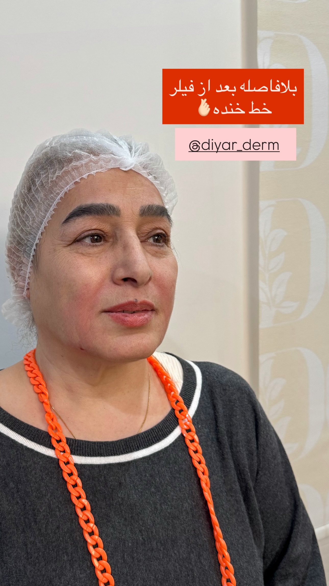  جدید ترین استوری اینستاگرام parastoo.jabbari
