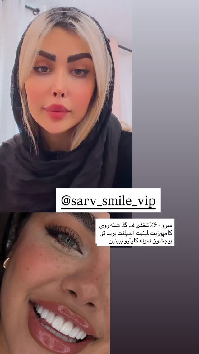  جدید ترین استوری اینستاگرام پریسا غریبی