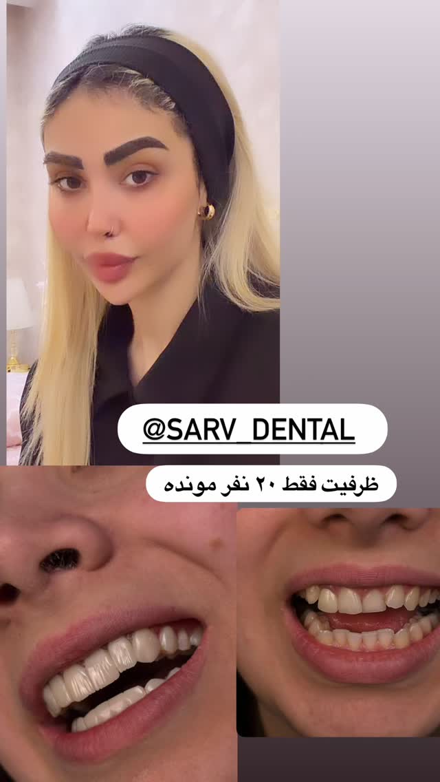  جدید ترین استوری اینستاگرام پریسا غریبی