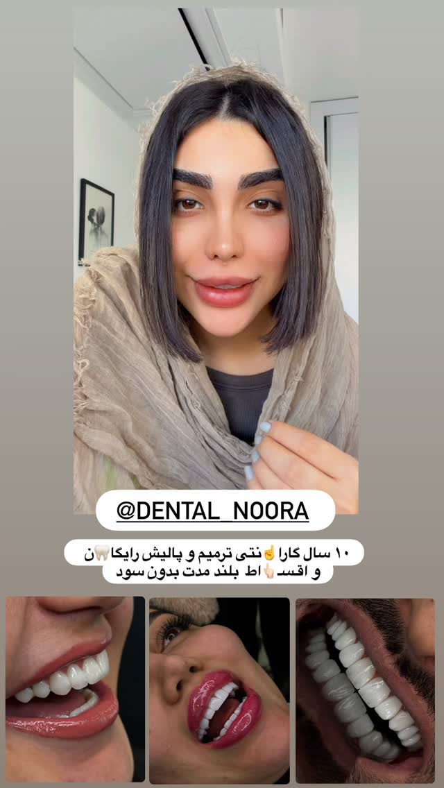  جدید ترین استوری اینستاگرام پری آ