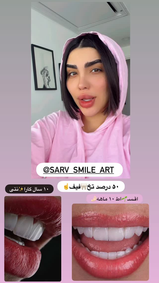  جدید ترین استوری اینستاگرام پری آ