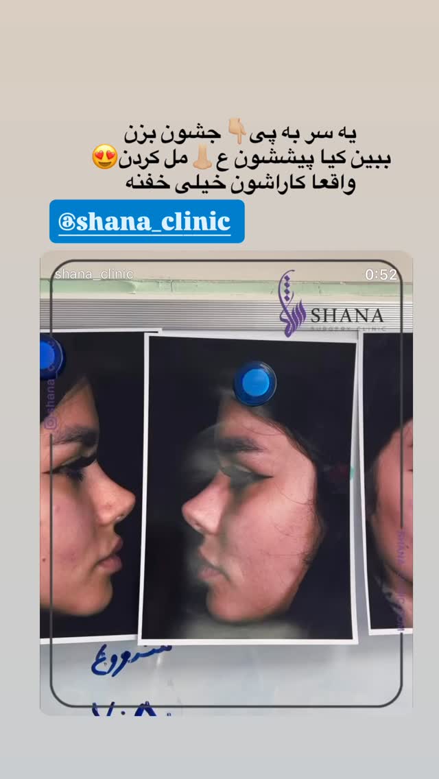  جدید ترین استوری اینستاگرام پری آ
