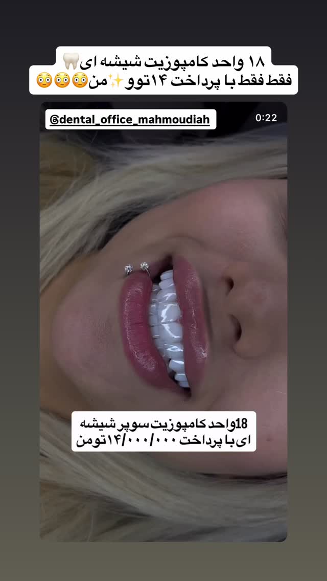 جدید ترین استوری اینستاگرام پری آ